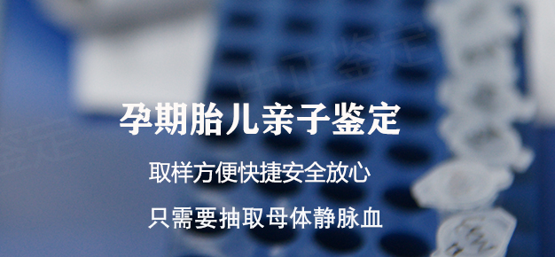 沈阳孕期如何偷偷做亲子鉴定,沈阳产前亲子鉴定准确可靠吗 沈阳孕期如何偷偷做亲子鉴定,沈阳产前亲子鉴定准确可靠吗